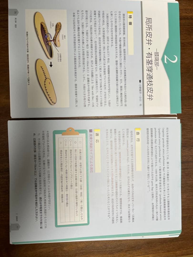 局所皮弁 第3巻