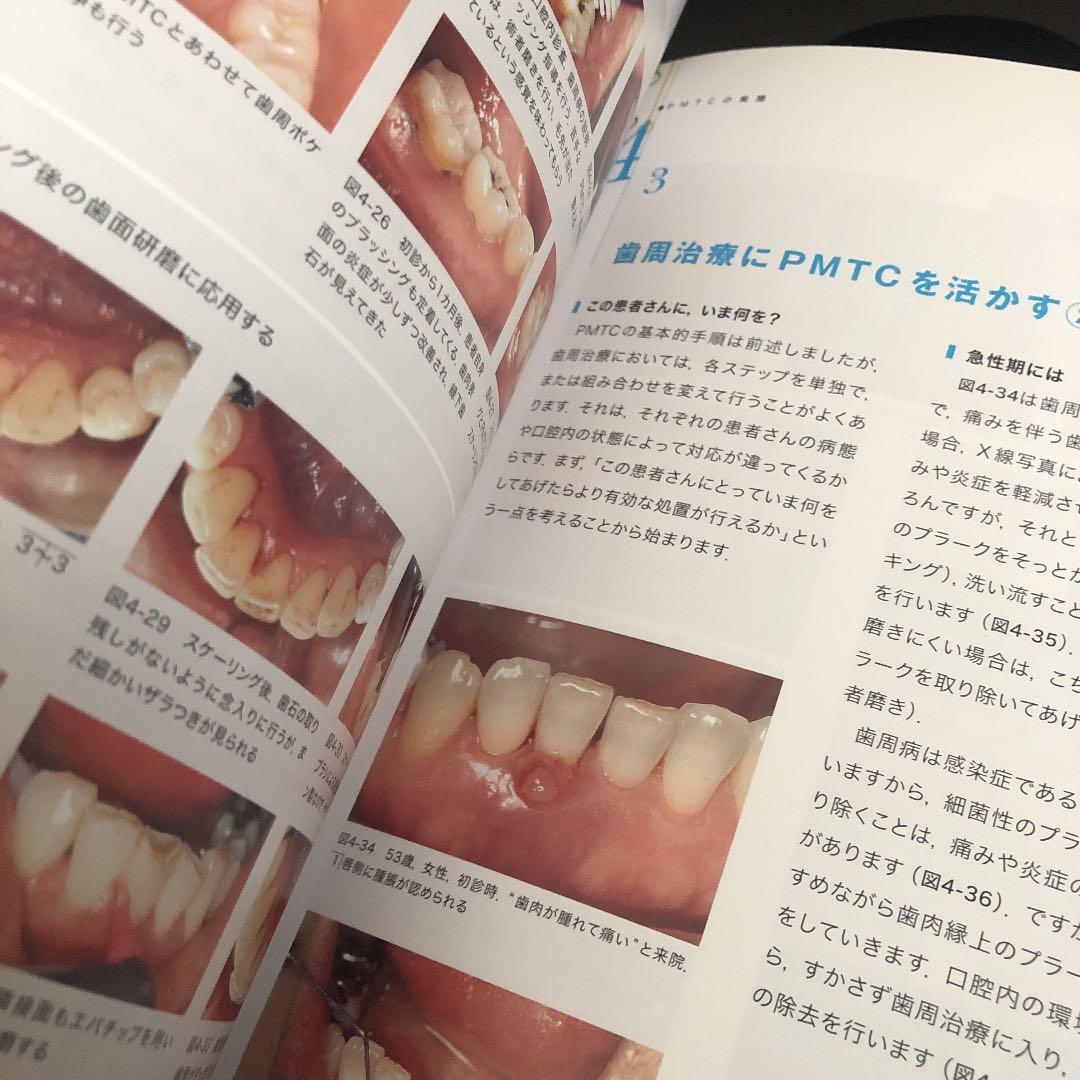 新品❣️新PMTC 予防・メインテナンス・SPTのためのプロケアテクニック
