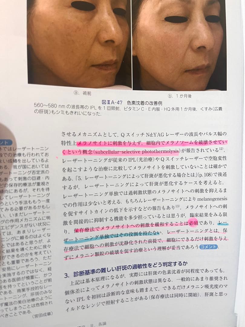 裁断済　Non-Surgical 美容医療 超実践講座