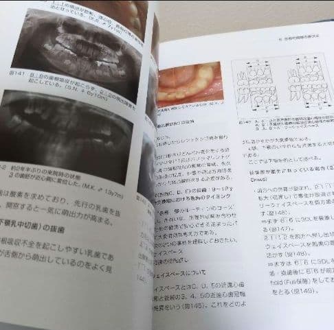歯科　医学本　まとめ売り