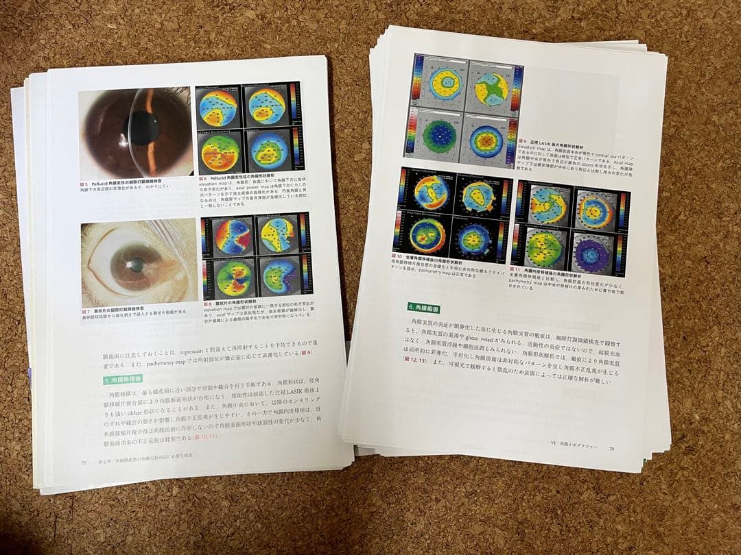 角結膜疾患の治療戦略 薬物治療と手術の最前線（裁断済み）
