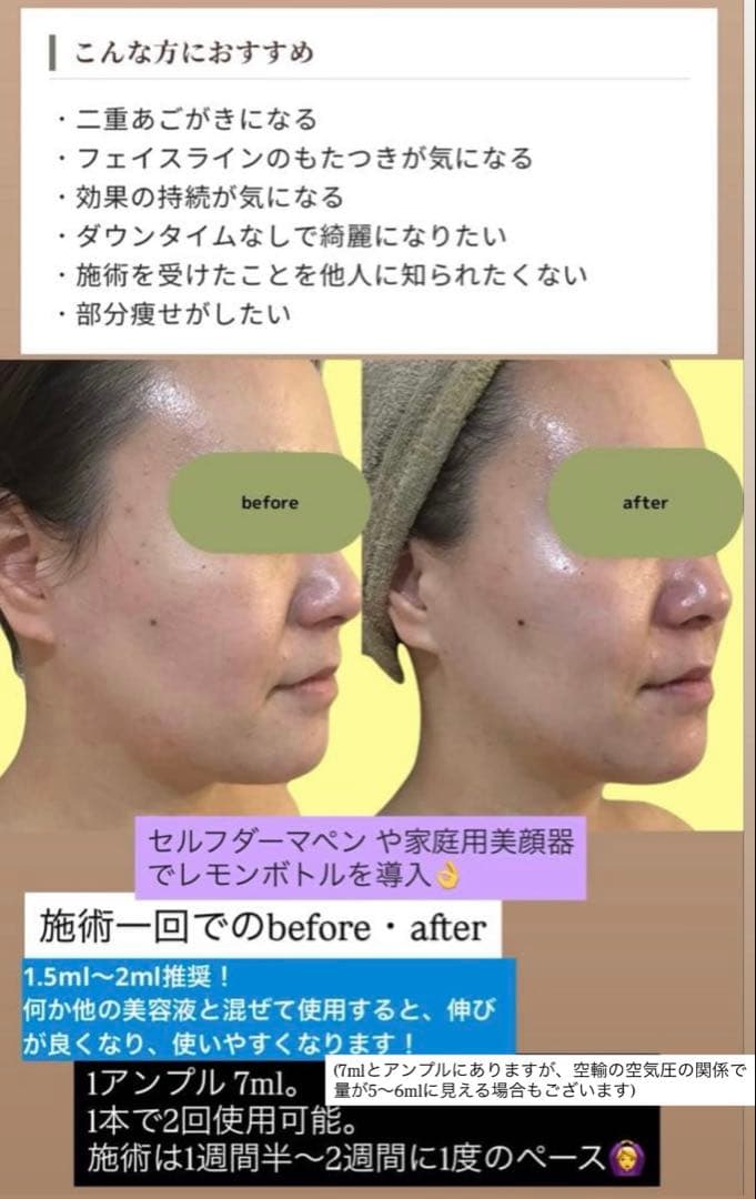 ally☆　レモンボトル×2本、幹細胞スカルプ美容液 、アプリケーター