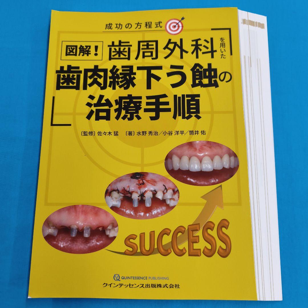 $裁断済 図解・歯周外科 歯肉縁下う蝕の治療手順