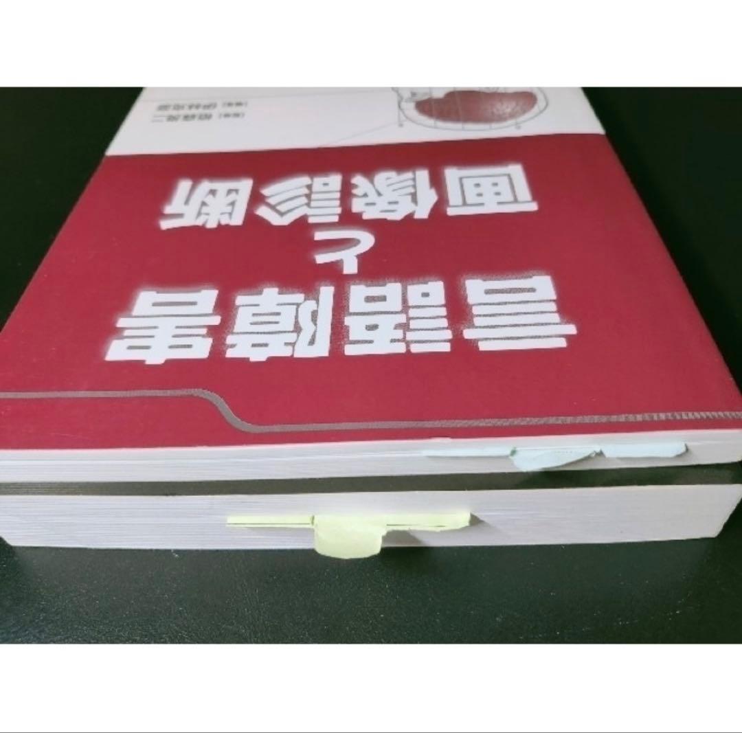 言語障害と画像診断 ＋ 失語症の理解のために