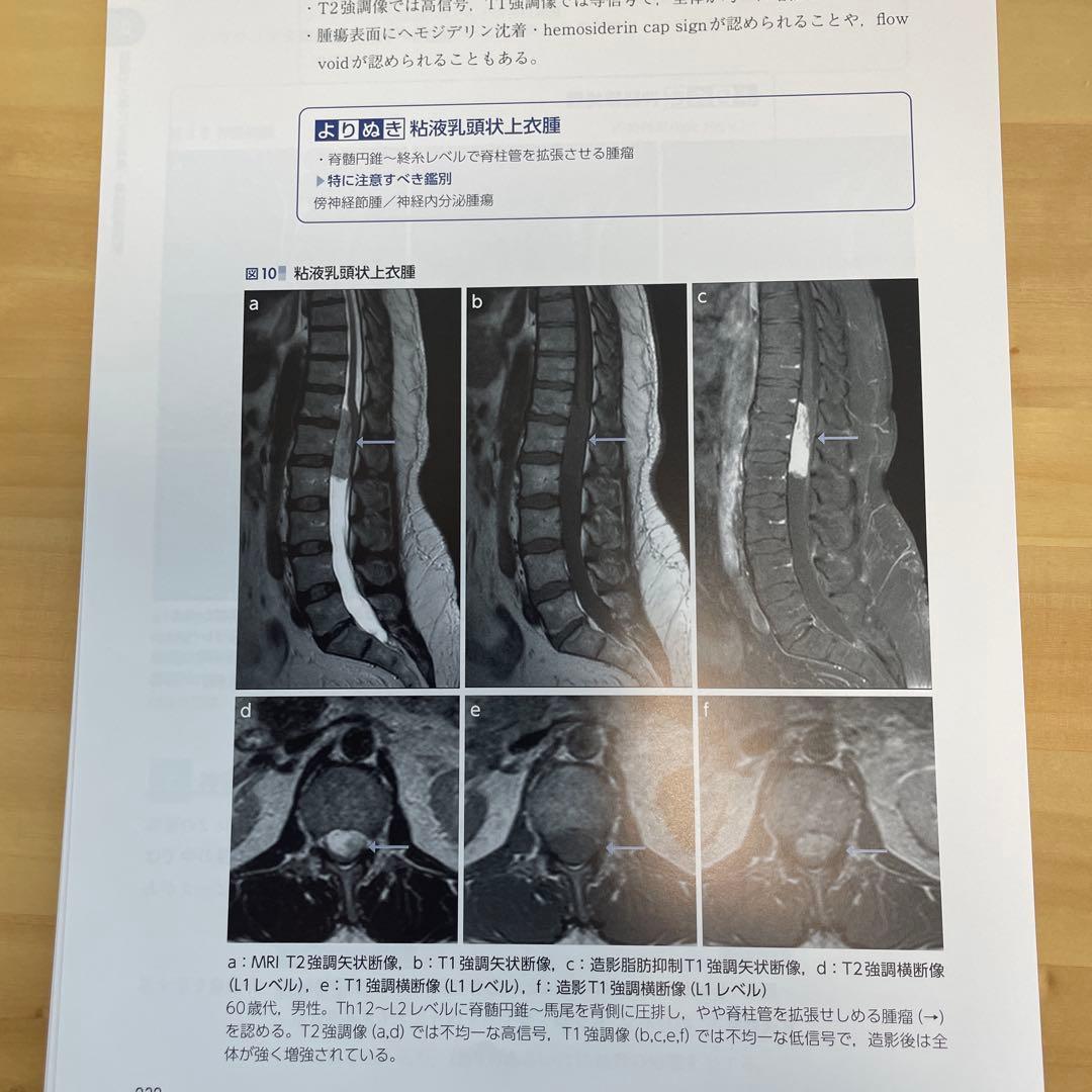 とにかく基礎から固める 脊椎の画像診断