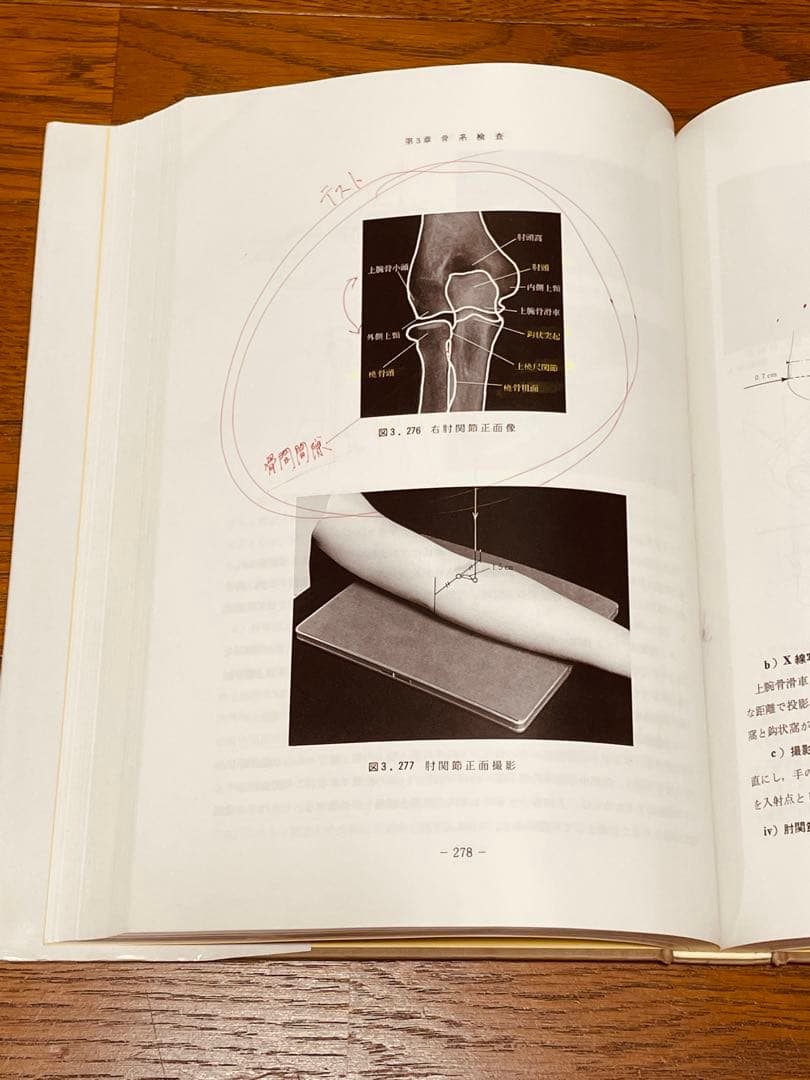 放射線検査学 X線