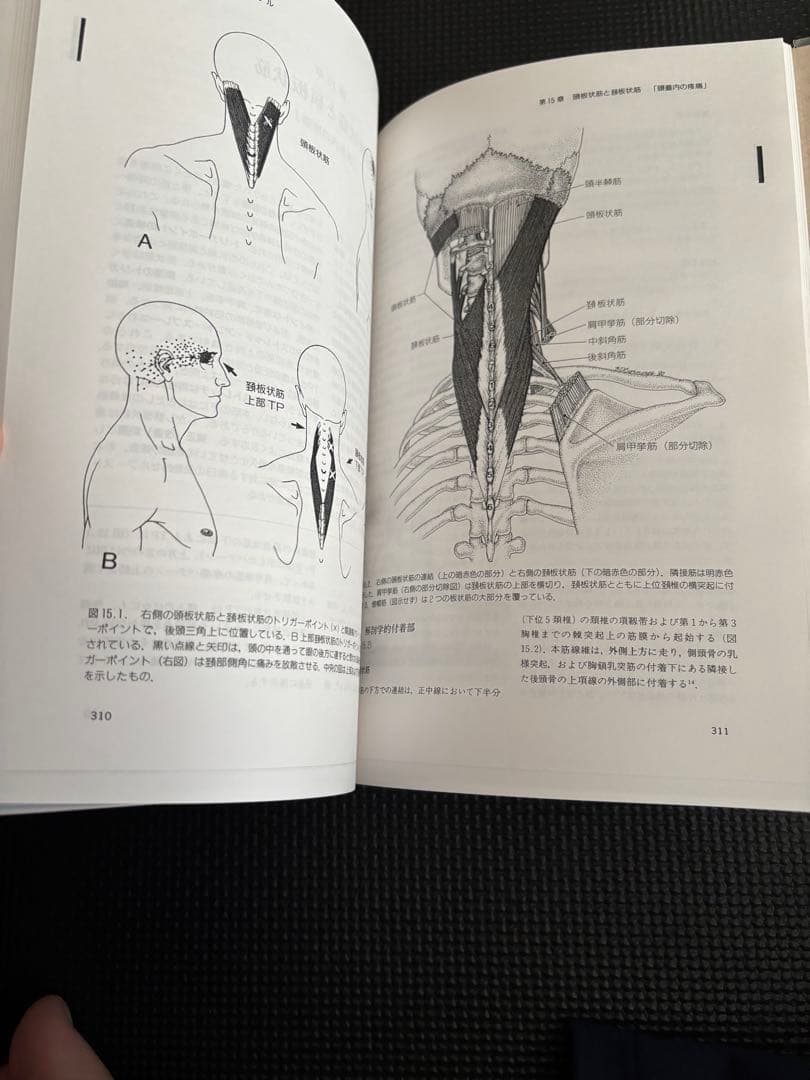 トリガーポイントマニュアル　筋膜痛と機能障害　第一巻　頭頸部編　値上げ予定