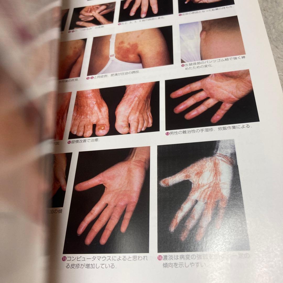 1-皮膚科診療のコツと落とし穴 1