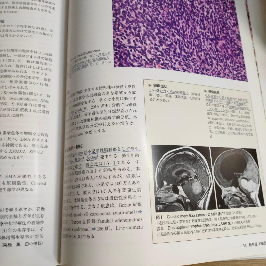 脳腫瘍臨床病理カラーアトラス 第4版