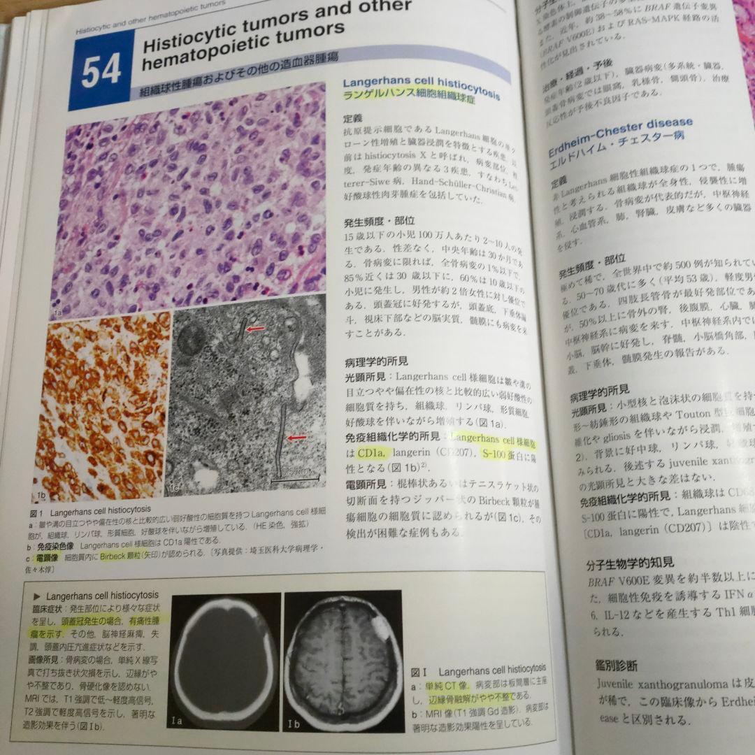 脳腫瘍臨床病理カラーアトラス 第4版
