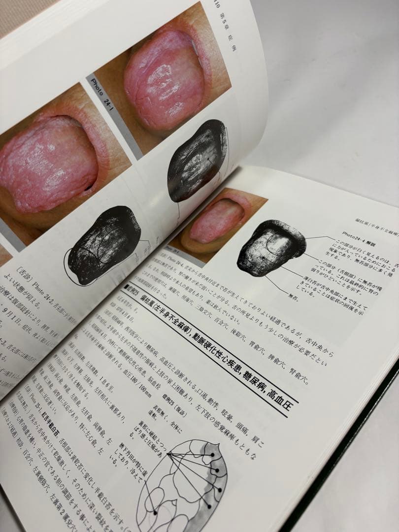 針灸舌診アトラス 診断基礎と臨床の実際