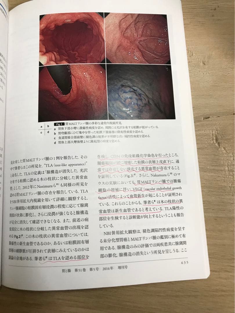 胃と腸 2016年 増刊号 消化管拡大内視鏡診断2016