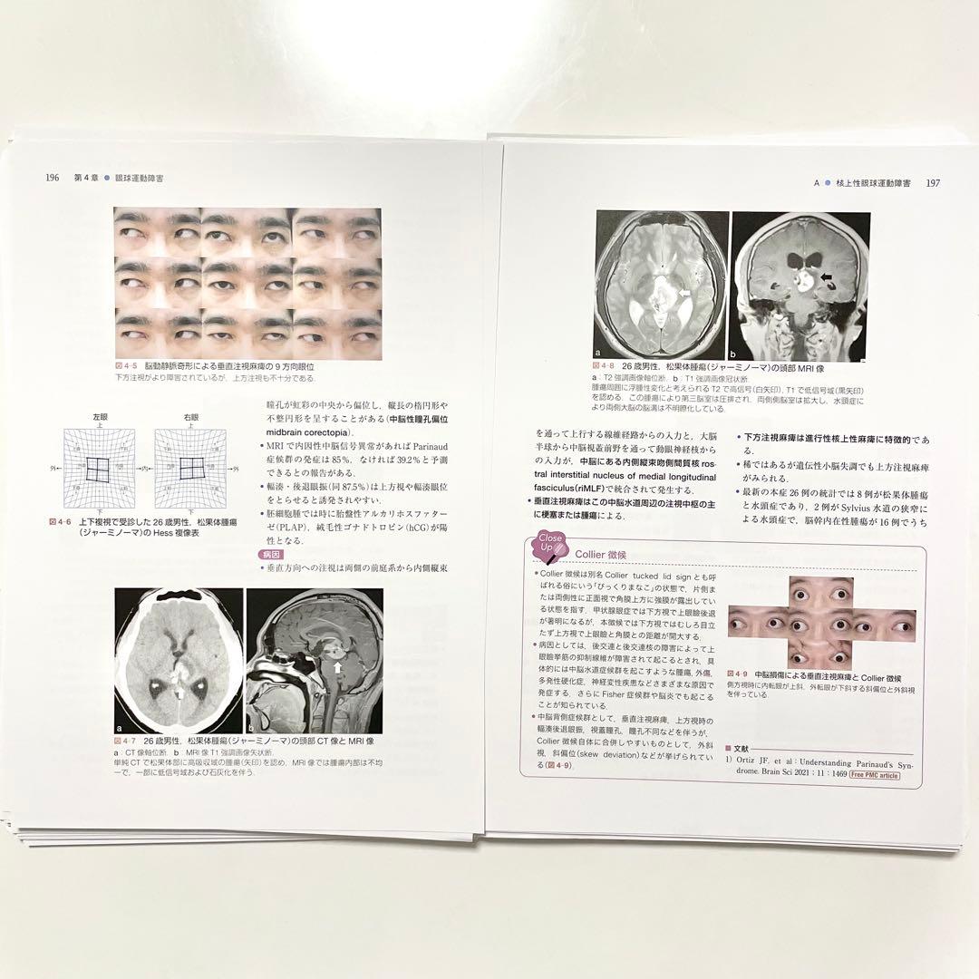 【裁断済み】神経眼科学を学ぶ人のために 第4版