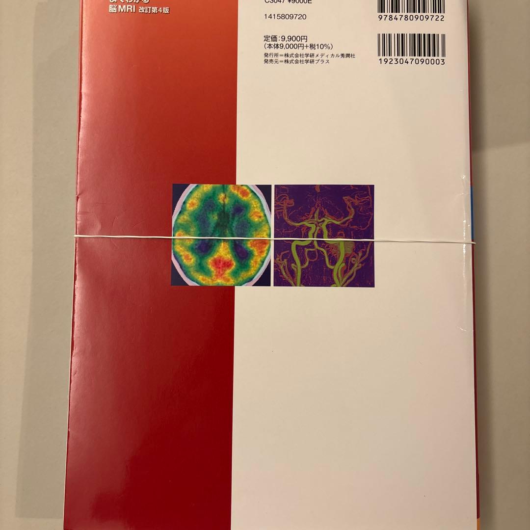 【裁断】よくわかる脳MRI