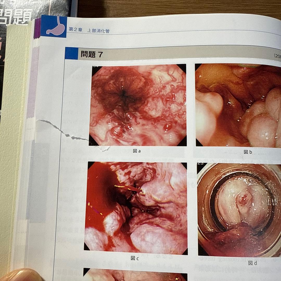 日本消化器内視鏡学会専門医学術試験問題〈解答と解説〉4版　5版　２冊セット