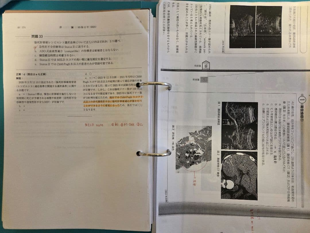 肝臓専門医試験テキスト・問題集など