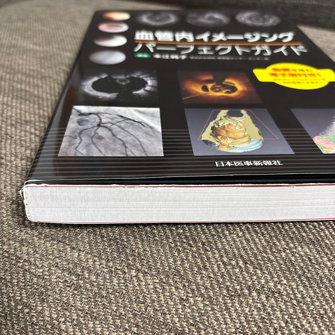 血管内イメージング　パーフェクトガイド