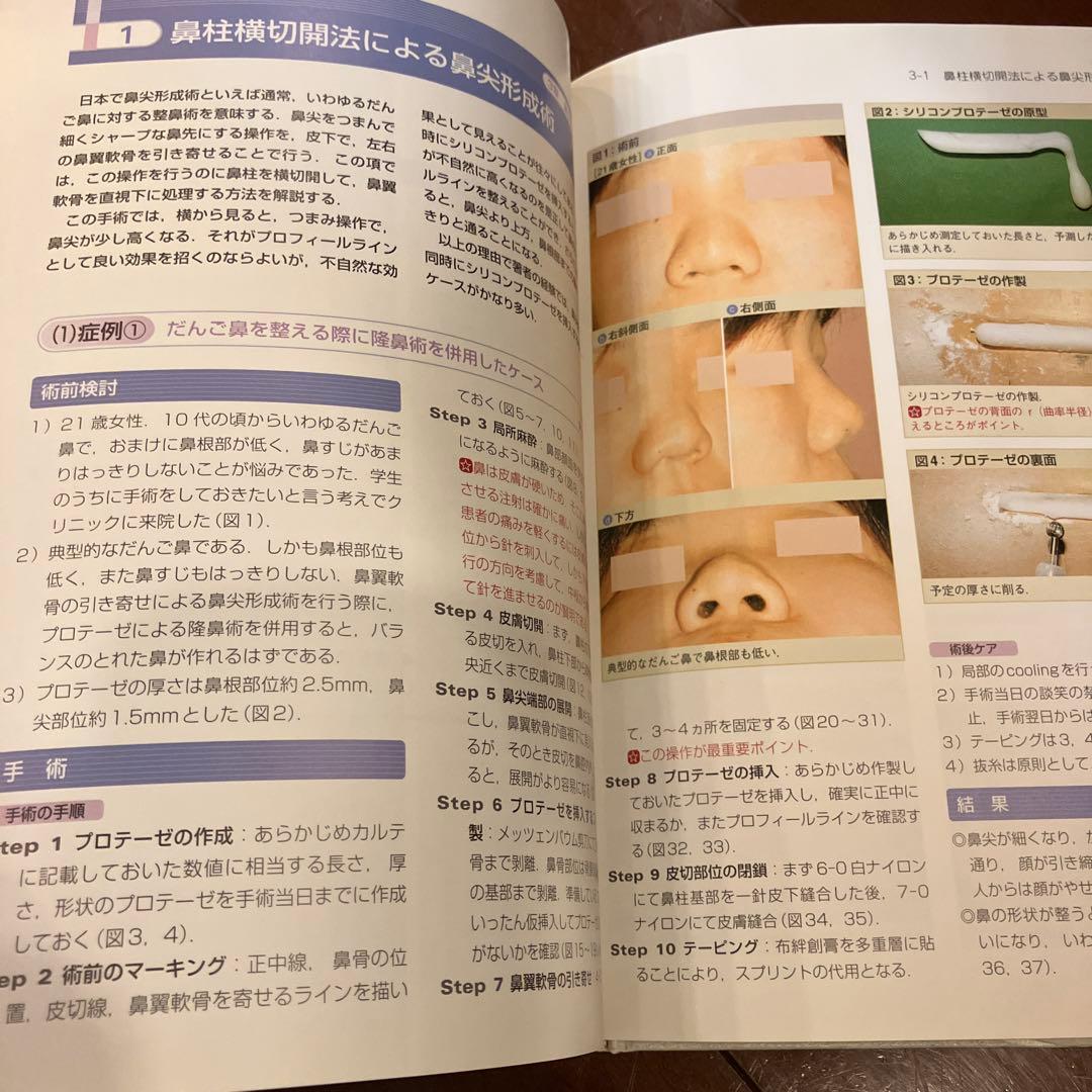 スキル美容外科手術アトラス 3