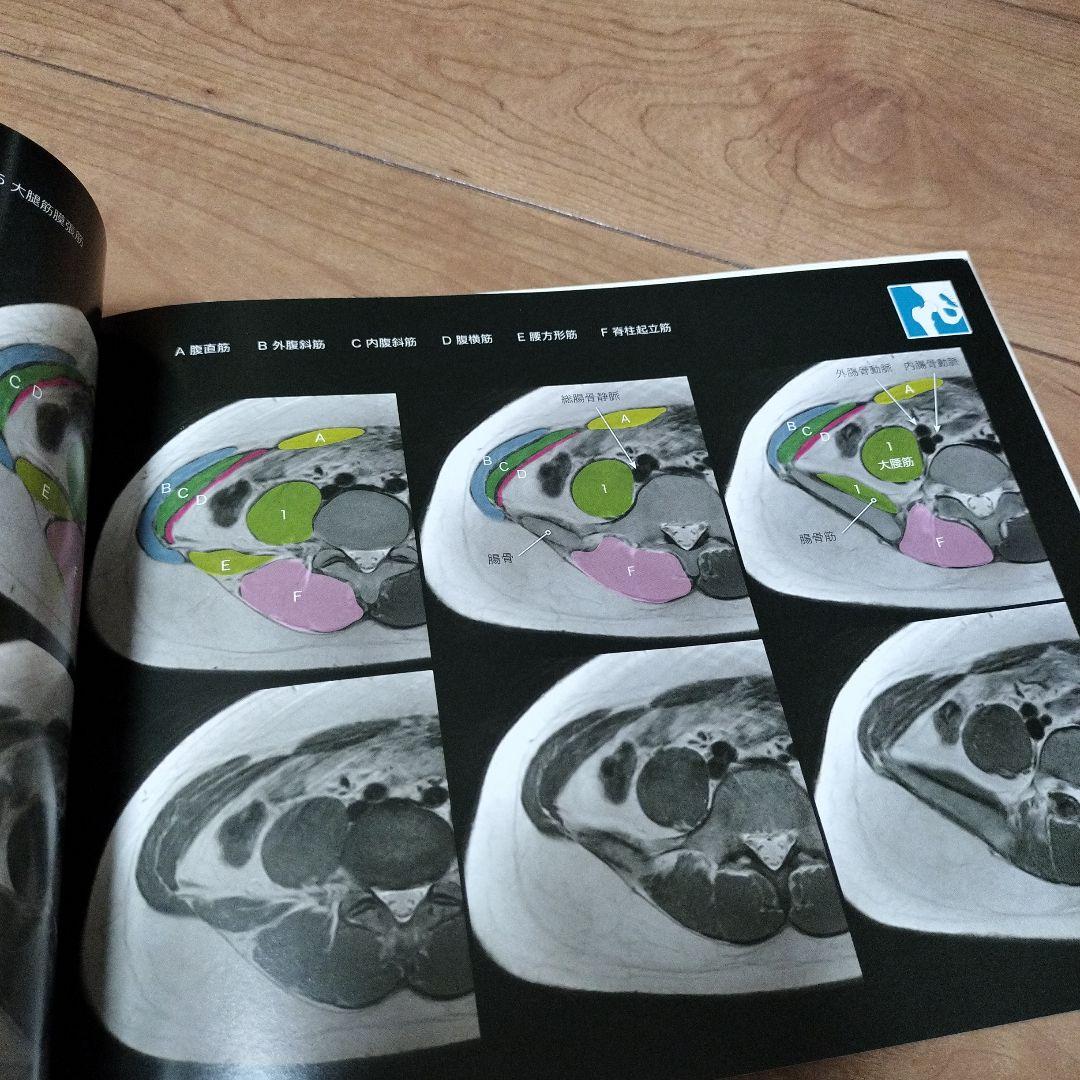 MRI断層解剖アトラス : 3Dで見る骨と筋 : 3D Anatomy Pro…