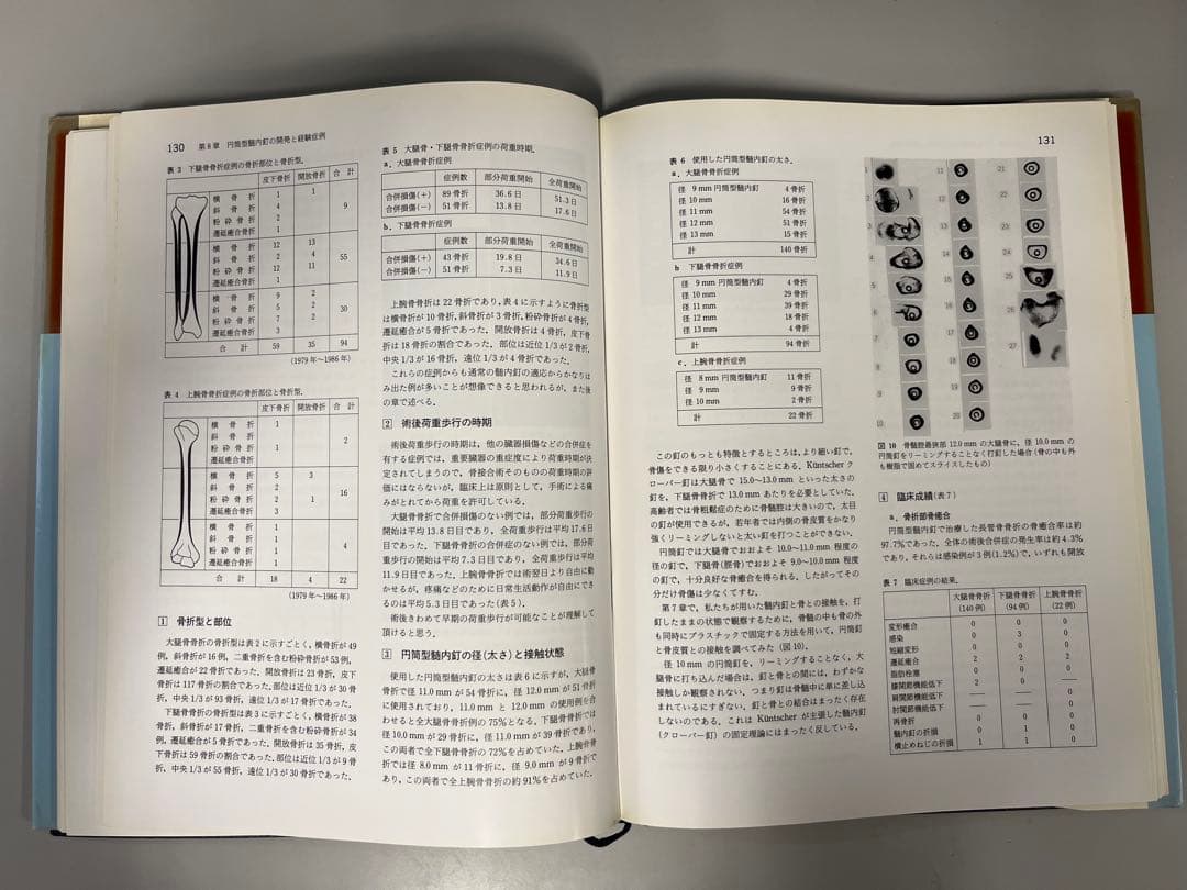 髄内釘による骨折手術