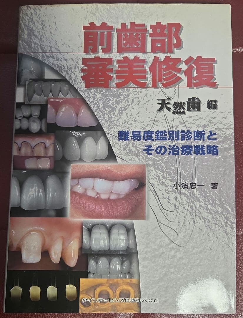 前歯部審美修復