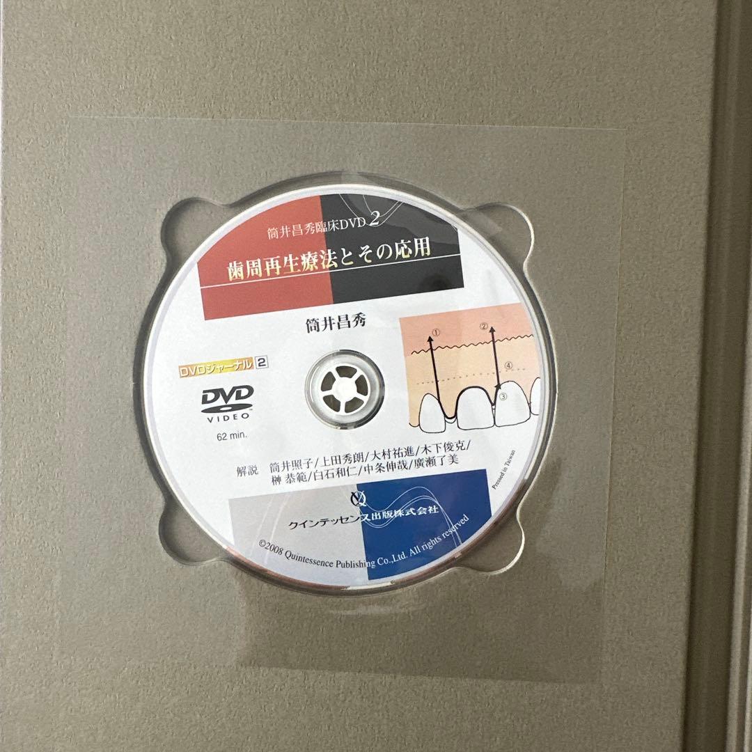 歯周再生療法とその応用