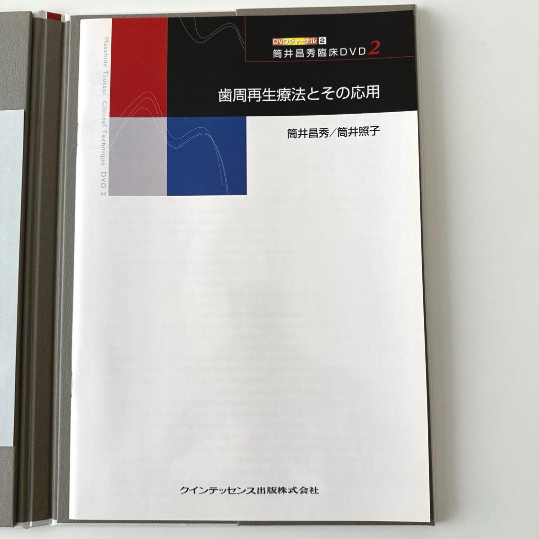 歯周再生療法とその応用