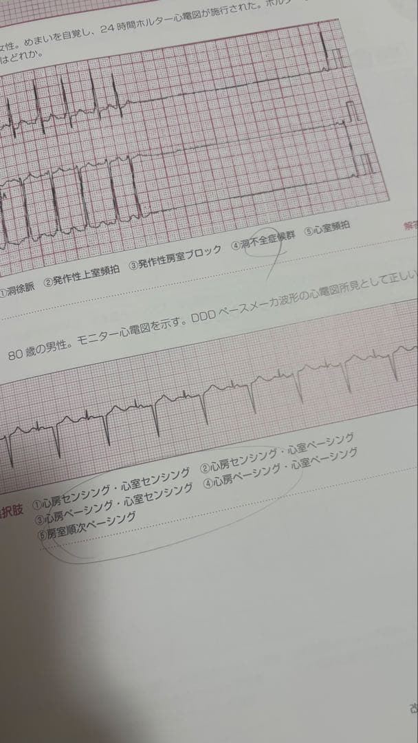 心電図検定 公式問題集 心電図の読み方パーフェクトマニュアル セット