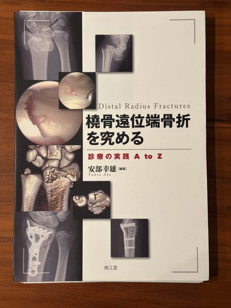 橈骨遠位端骨折を究める　診療の実践A to Z