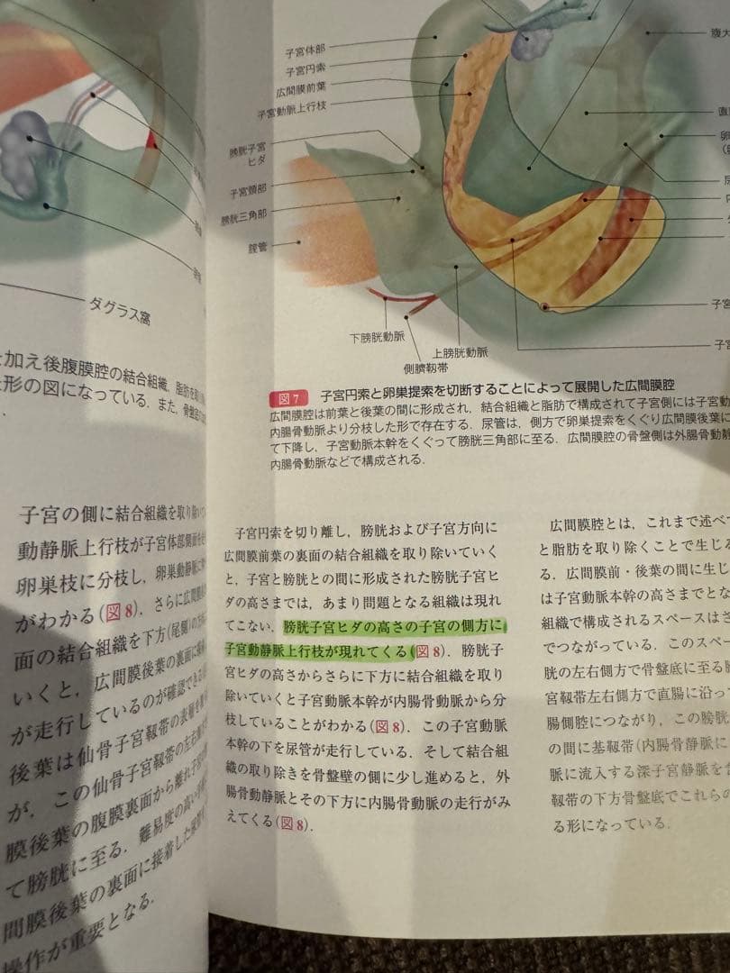 産婦人科手術シリーズ : 臨床解剖学に基づいた : カラーアトラス 1 DVD付