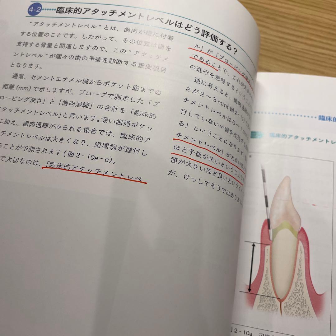 スーパーベーシックペリオドントロジー : 歯肉剥離掻爬術と遊離歯肉移植術までを…