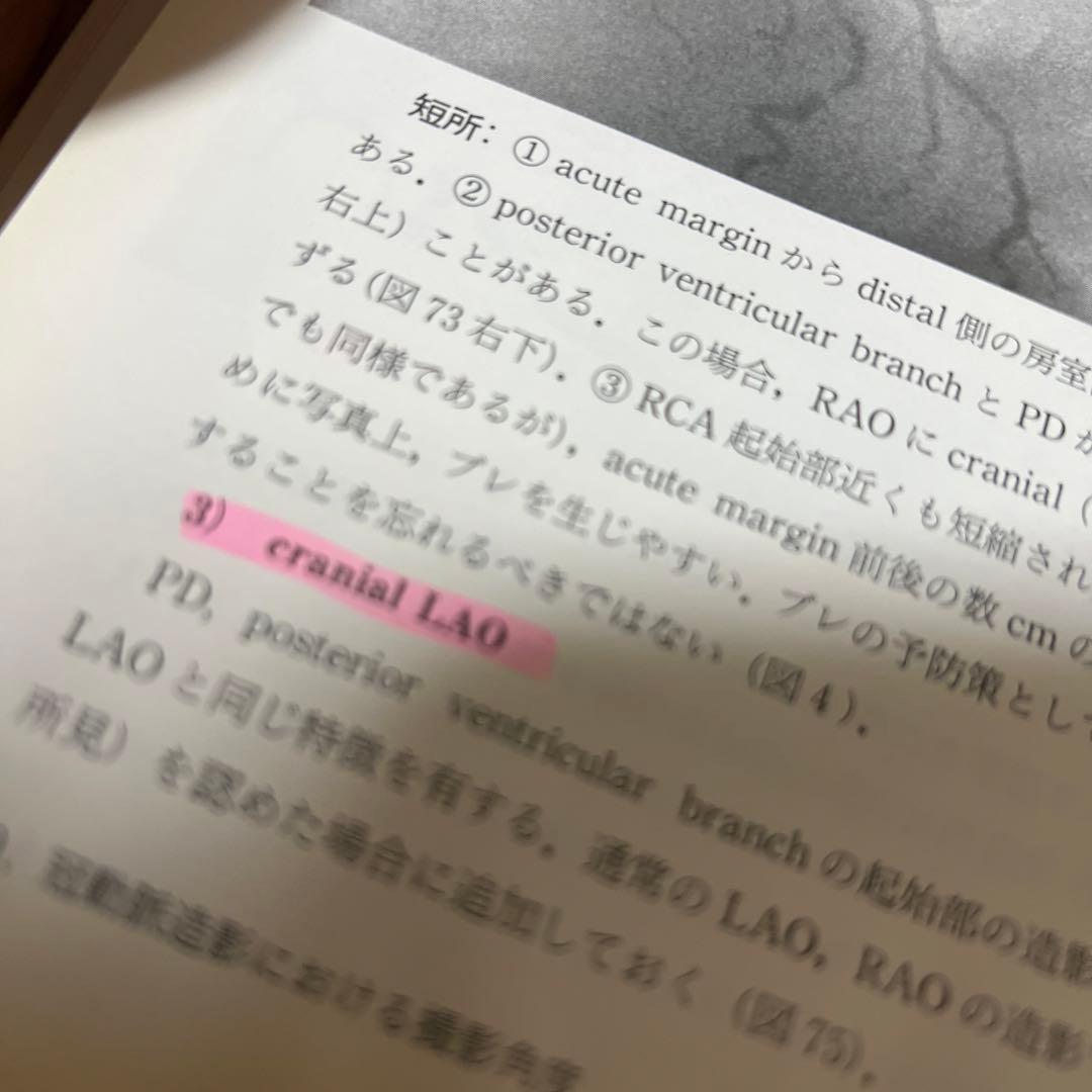 冠動脈造影の手技